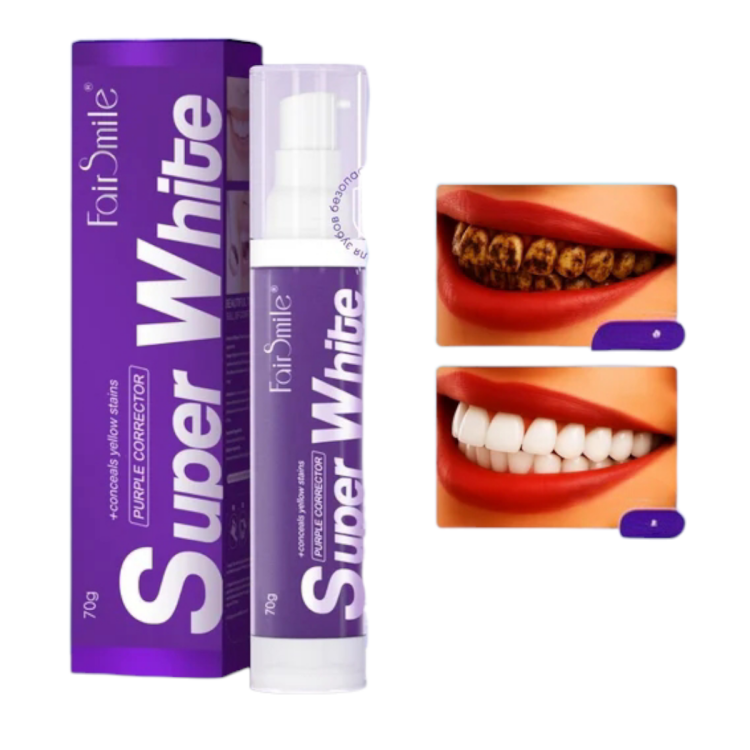 معجون اسنان سوبر وايت بتقنية البنفسجية لتبيض الاسنان بحجم 70 غم