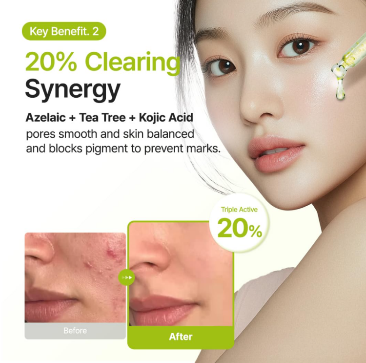 Purito SEOUL, Azelaic Acid 10 Kojic Tea Tree Serum