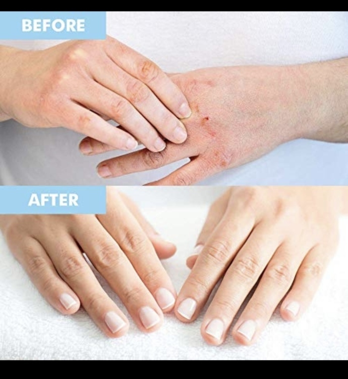 Nu-Pore, Hydrating Hand Mask