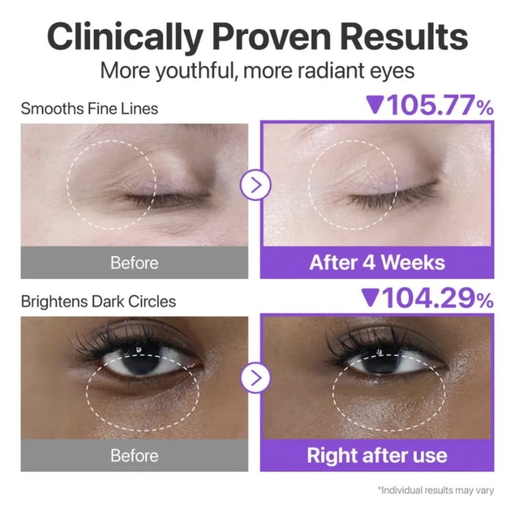 Numbuzin No.9 NAD+ Retinol Volume Tox Eye Cream /10ml