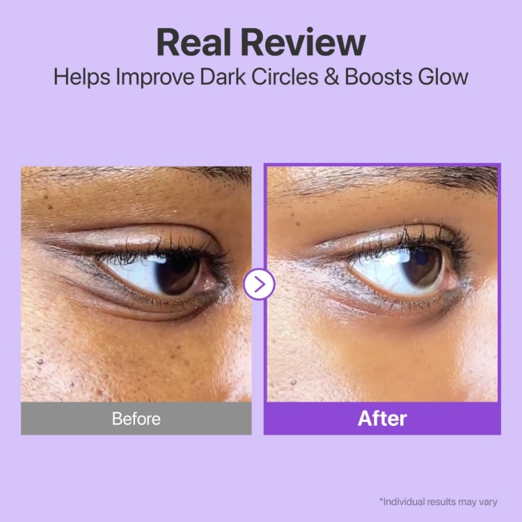 Numbuzin No.9 NAD+ Retinol Volume Tox Eye Cream /10ml