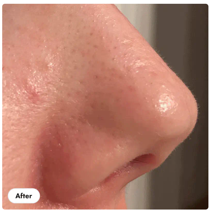 Hero Cosmetics, Pore Release The blackhead solution
