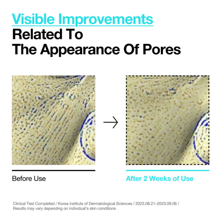 Anua, BHA 2% Gentle Exfoliating Toner