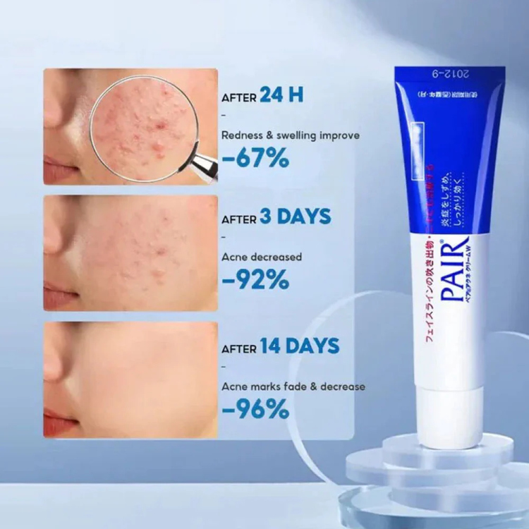 LION – Pair Acne Cream W. كريم باير لعلاج الحبوب من LION - فعالية يابانية يومية