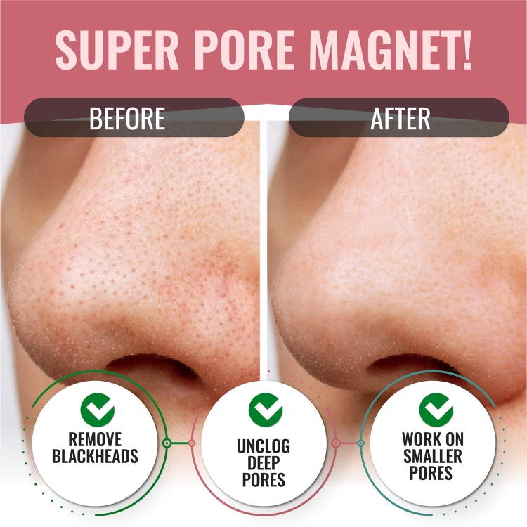 Nose Pore Strips Charcoal 5 pcs لاصقات الفحم لازالة الرؤوس السوداء و البيضاء (5 قطع )