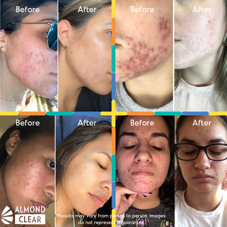 Almond Clear Level 1 Serum 