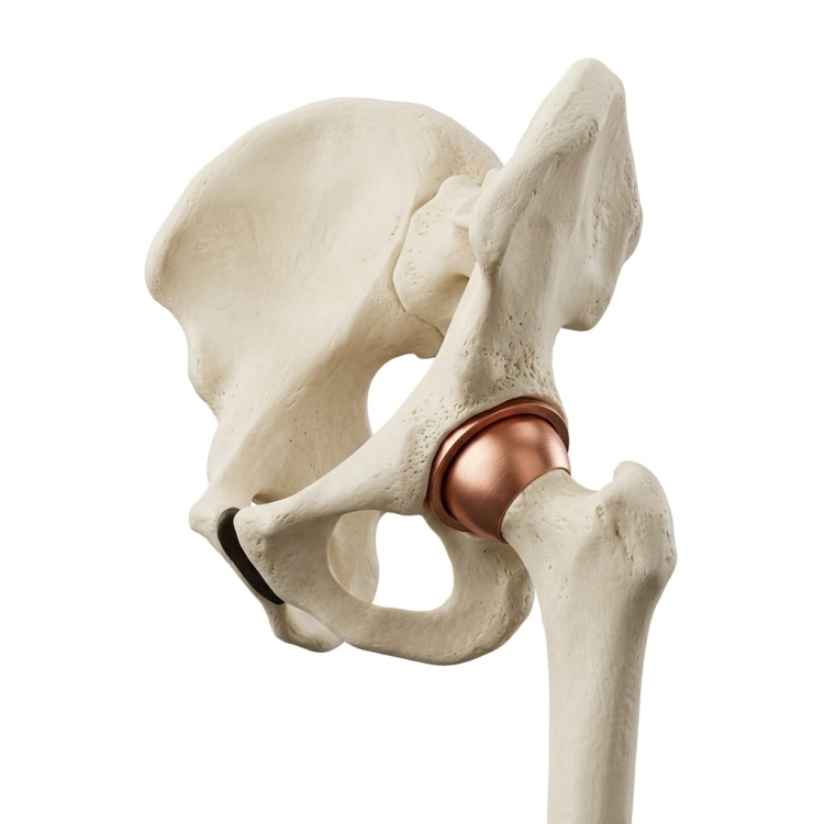 مفصل الورك البشري