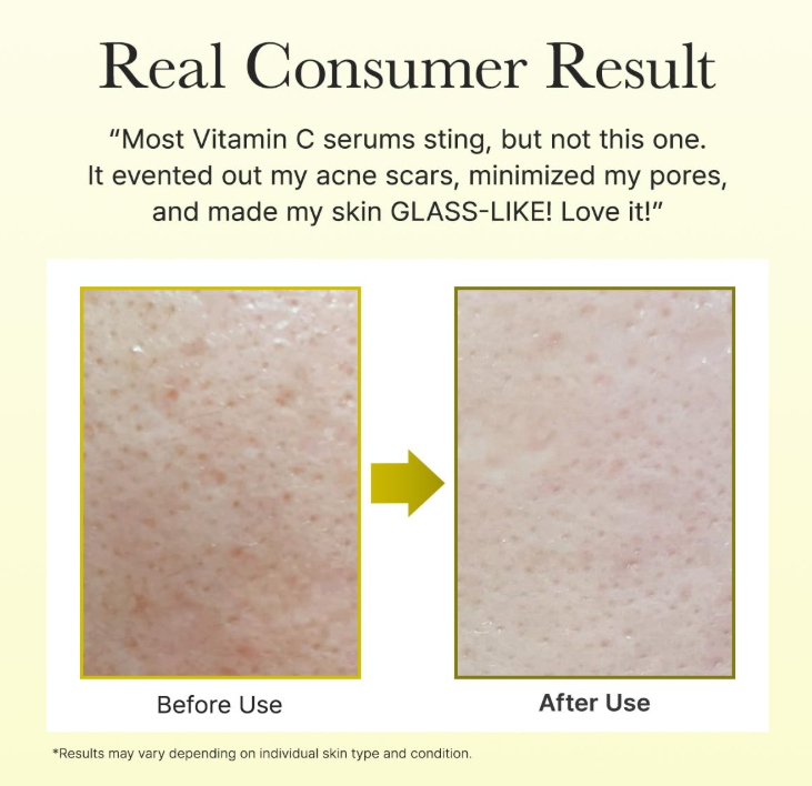 Arencia, Vitamin C Booster Shot