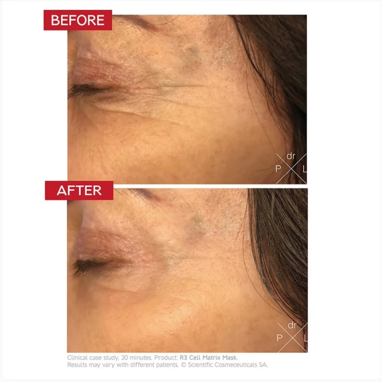 Dr. LEVY Switzerland R3 Cell Matrix Mask 50ml 