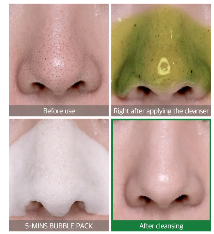 Some By Mi, Bye Bye Blackhead 30 Days Miracle Green Tea Tox Bubble Cleanser
