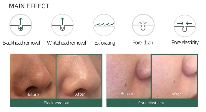 Some By Mi, Bye Bye Blackhead 30 Days Miracle Green Tea Tox Bubble Cleanser