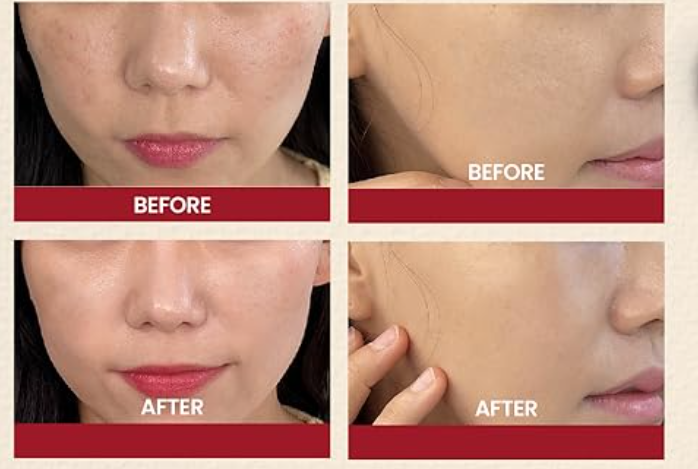 KSECRET, SEOUL 1988 Essence : Snail Mucin 97% + Rice