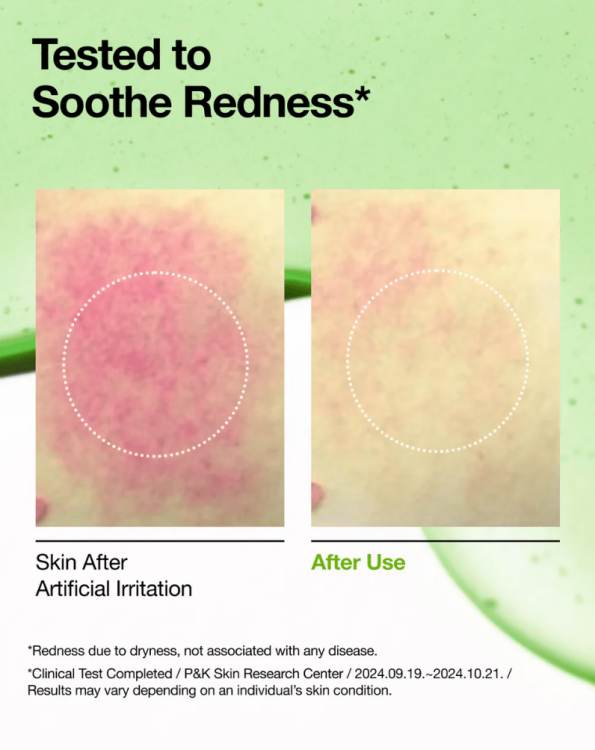 Anua - Azelaic Acid 10 Hyaluron Redness Soothing Serum/30ml