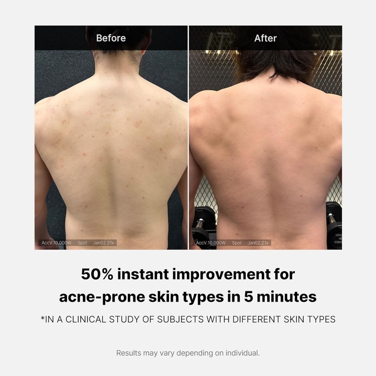 medicube, Red Acne Body Wash