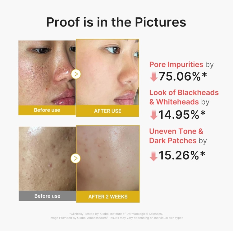 medicube, Kojic Acid Turmeric Peel Shot