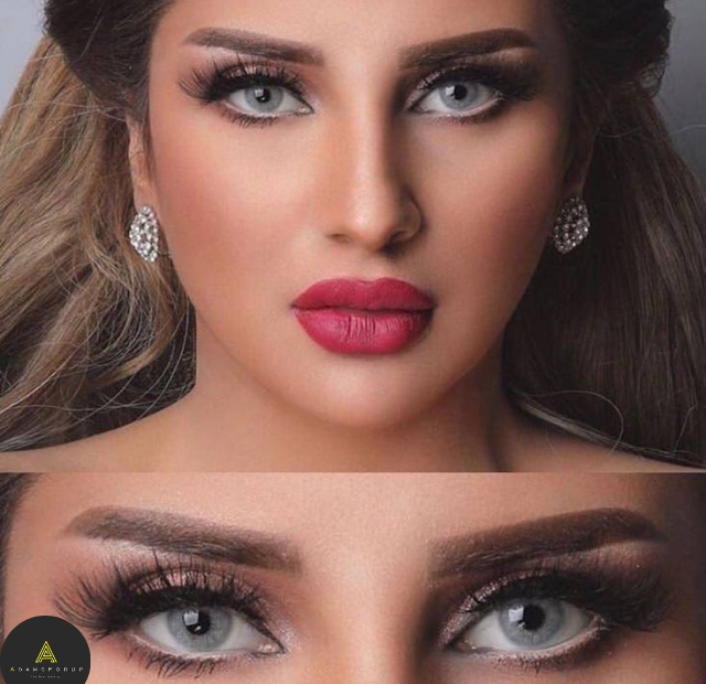 بيرلا