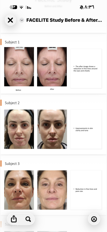 Face lite 