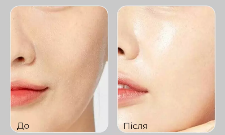MEDI-PEEL, Peptide 9 Volume White Cica Essence Pro