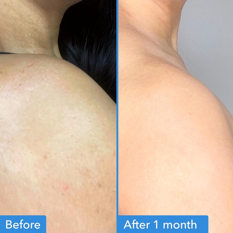 Good molecules, Discoloration Correcting Body Treatment