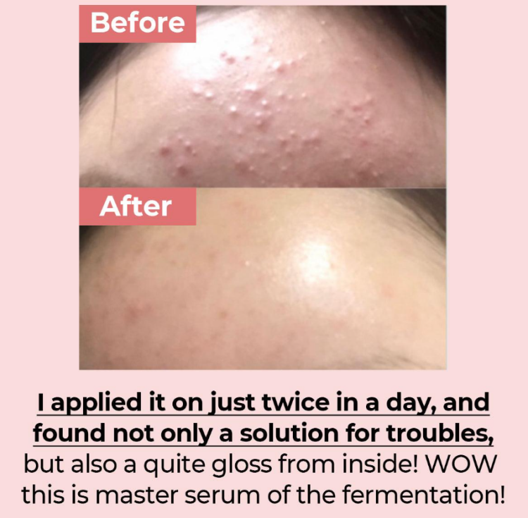 Numbuzin, No. 3 Skin Softening Serum