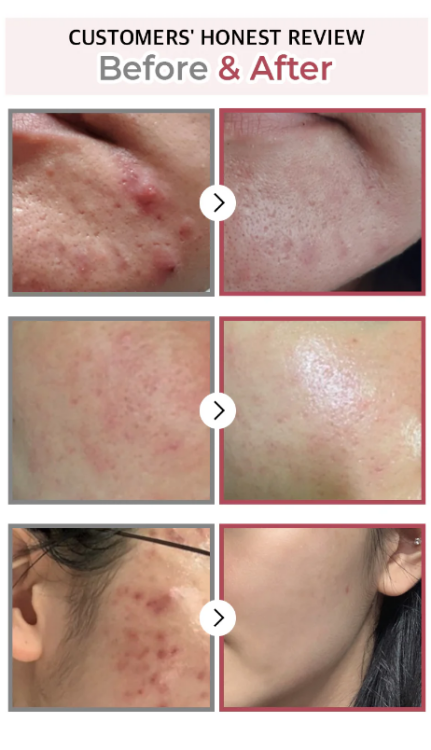 Numbuzin, No. 3 Skin Softening Serum
