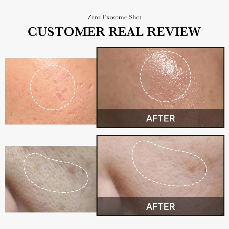 Medicube One Day Exosome Shot Pore Ampoule سيروم الاكسوزوم الابر الكوري