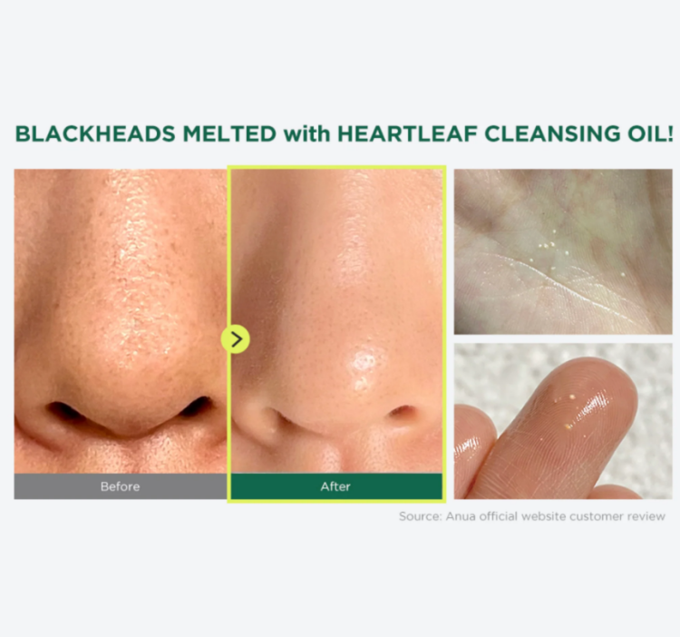 Anua, Heartleaf Toner + Cleansing Oil Set