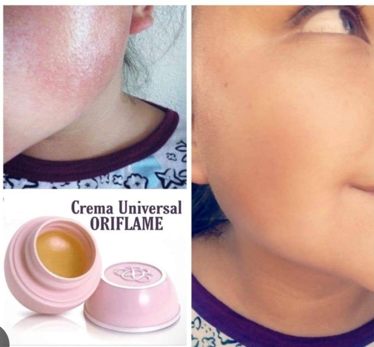 Tender Care Protecting Balm 15ml - 1276