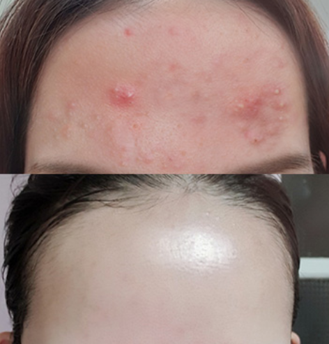 Some By Mi, AHA BHA PHA 30 Days Miracle Cream 