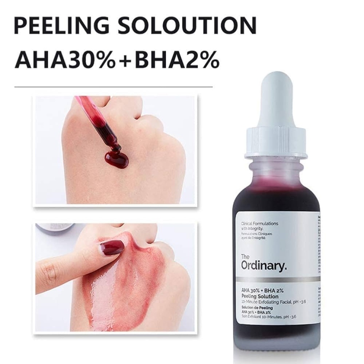 Peeling solution the ordinary 