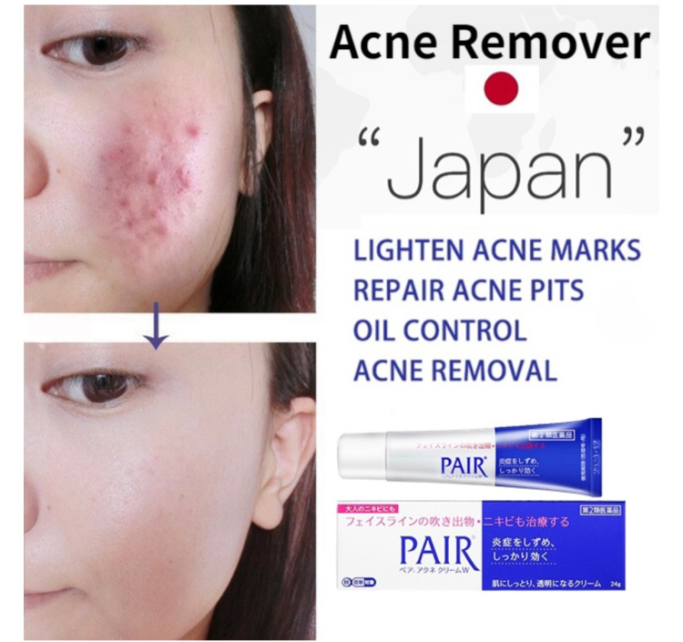 Lion Pair Acne Cream 
