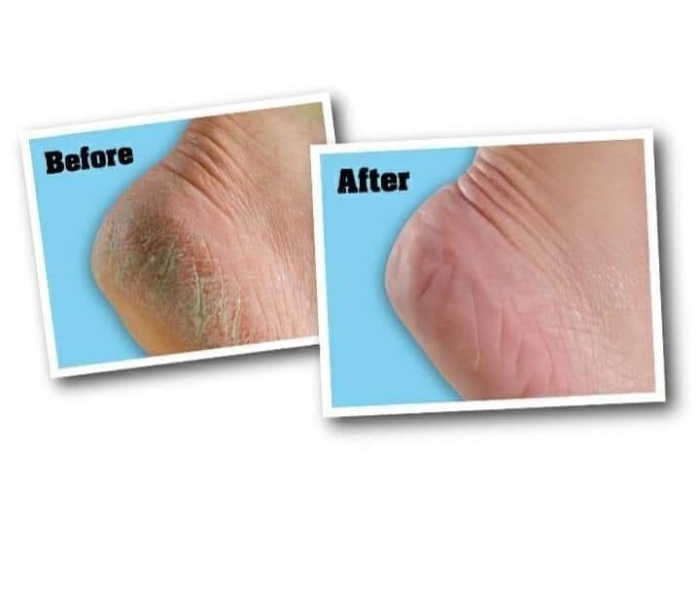 Healthy Feet Foot Cream