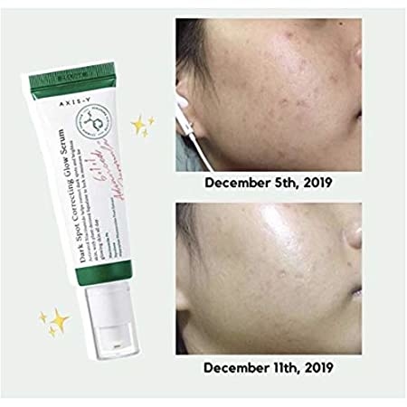 AXIS-Y, Dark Spot Correcting Niacinamide Glow Serum 