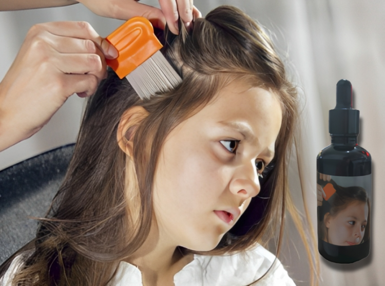 سيروم  ازالة القمل 50 مل