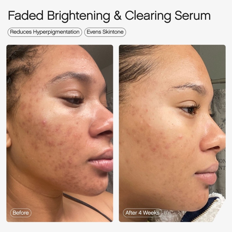 Topicals, Faded Serum for Dark Spots & Discoloration