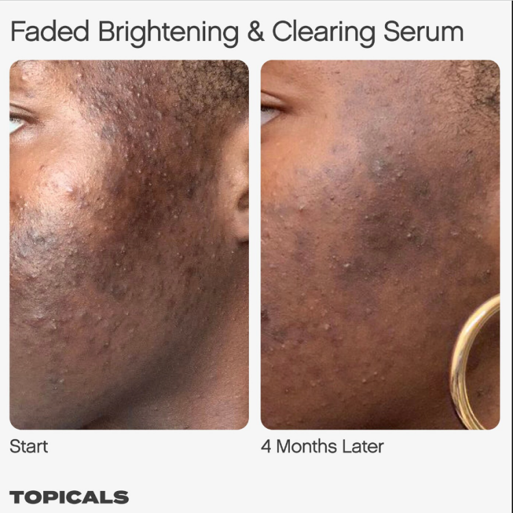 Topicals, Faded Serum for Dark Spots & Discoloration