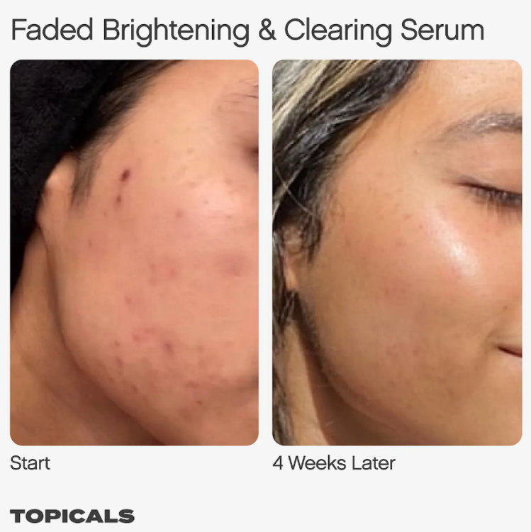 Topicals, Faded Serum for Dark Spots & Discoloration