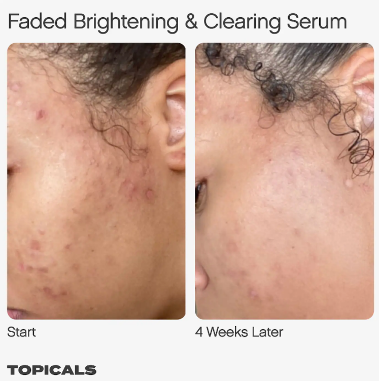 Topicals, Faded Serum for Dark Spots & Discoloration