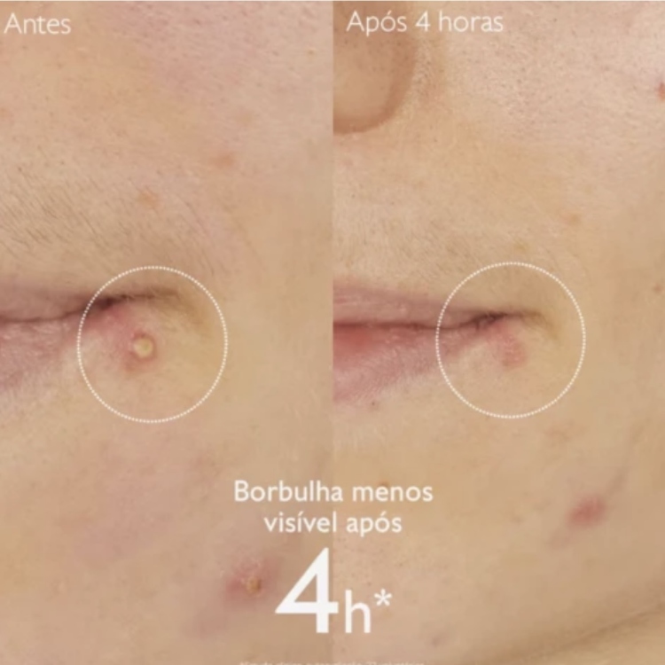 CAUDALÍE Vinopure Salicylic Spot Solution 15mL