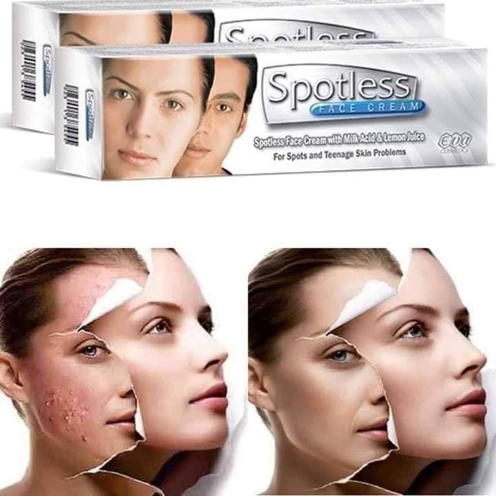 كريم سبوتلس Spotless cream