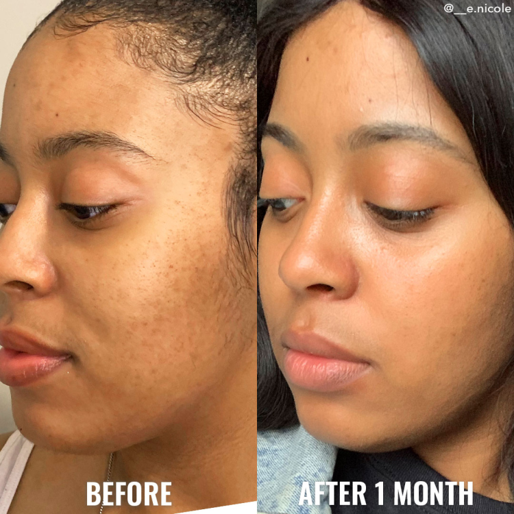Good molecules GLYCOLIC EXFOLIATING TONER تونر حمض الجليكوليك للتقشير