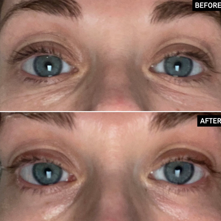The Inkey List, Retinol Eye Cream